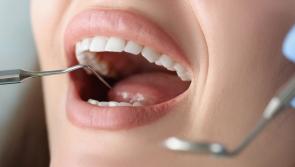 Cash sweetener being offered to Devon dentists to take on more urgent cases 