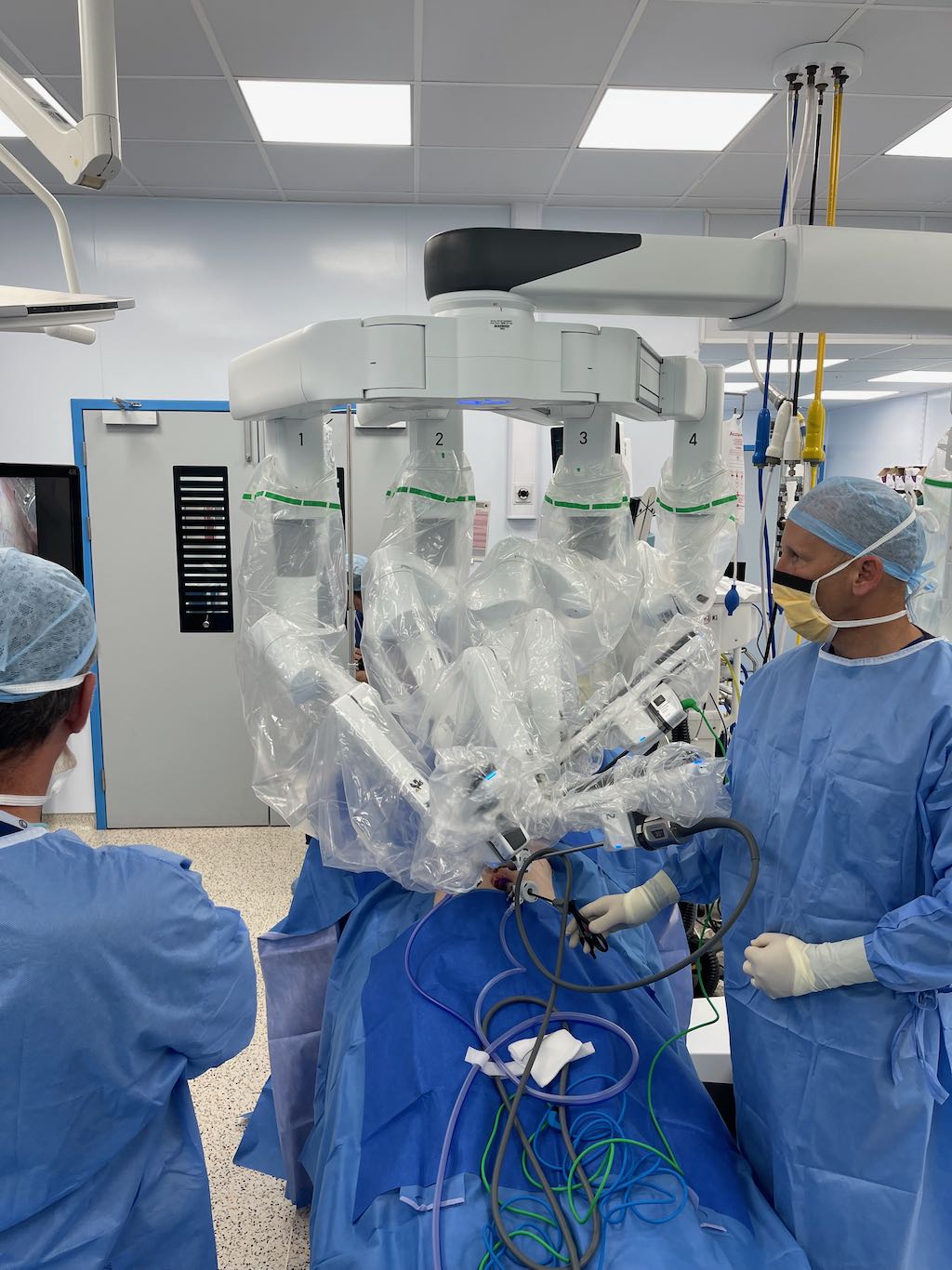 Surgeons at NDDH are now performing robotic surgery for hiatal hernias, inguinal hernias and gallbladder removal